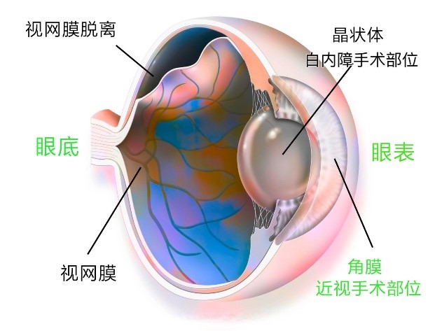 三氣培養(yǎng)箱在視網(wǎng)膜低氧疾病研究中的應用及機制探索